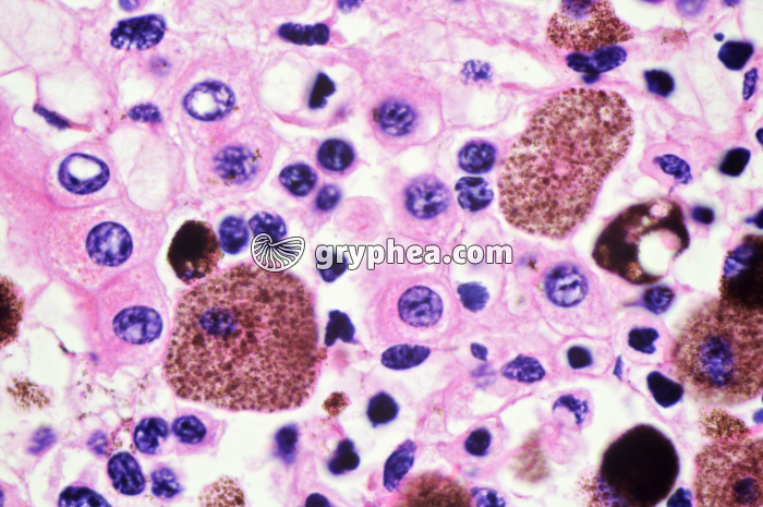 Foie x170 - gryphea.org